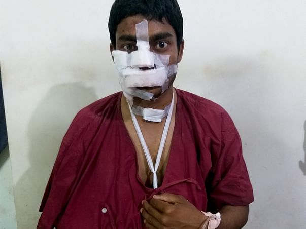 Help Ankush Recover From An Accident