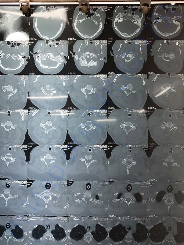 Please view this ct scan