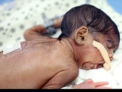 My baby can’t breathe without ventilator support and I can’t fund her