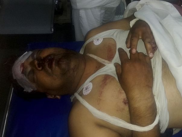 Help Manoj to survive Road Accident