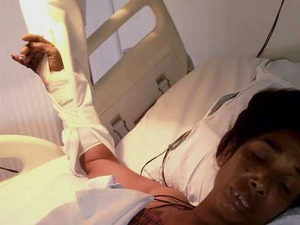 Help Valli Recover From An Accident
