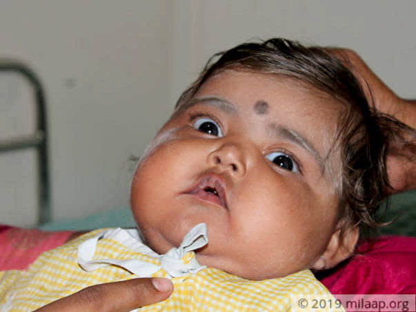 Help My Baby Fight Griscelli Syndrome