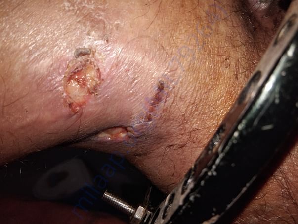 Leg image
