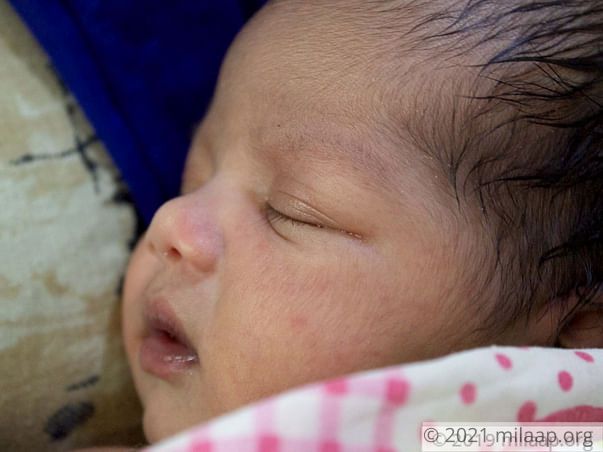 Baby of Pragya needs your help to survive