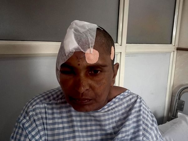 Help Latha Who's Fighting With Brain Tumour And Cancer