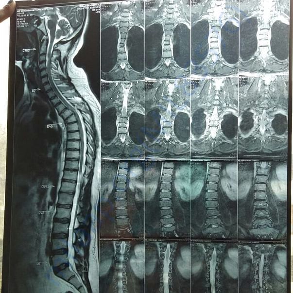 Medical Report