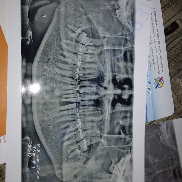 Medical Report