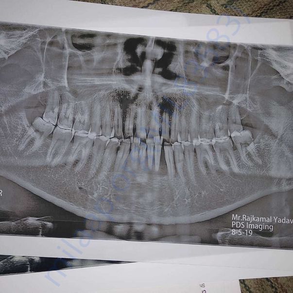 Medical Report