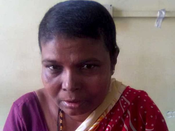 Help My Mother Fight Cancer