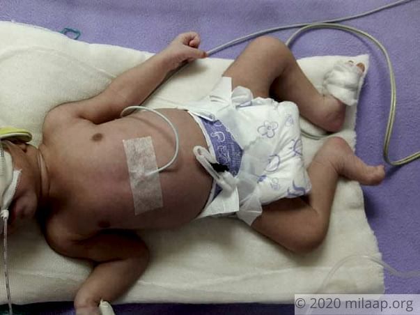 Help Baby of Mosarrat Survive
