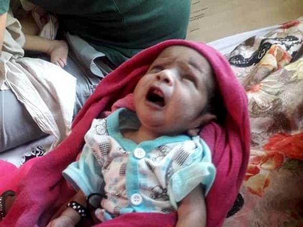 Help Baby Aarohi Undergo Open Heart Surgery