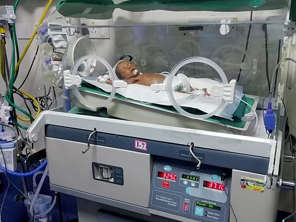 Help Baby Of Nandish To Recover
