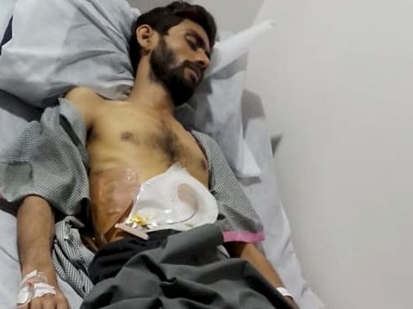Help my brother recover from Liver disease and Brain Fever