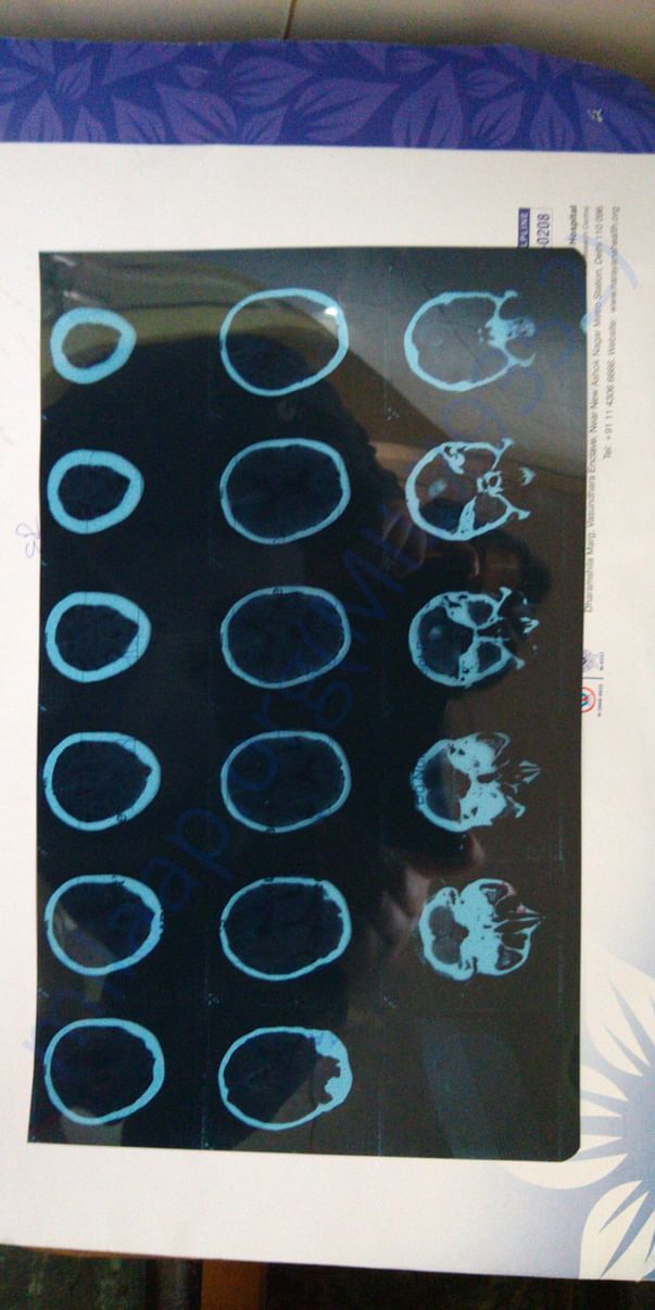MRI report