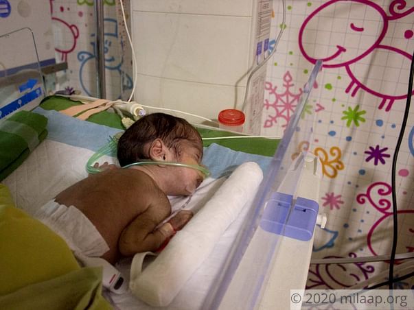 Baby of Pooja needs your help to survive