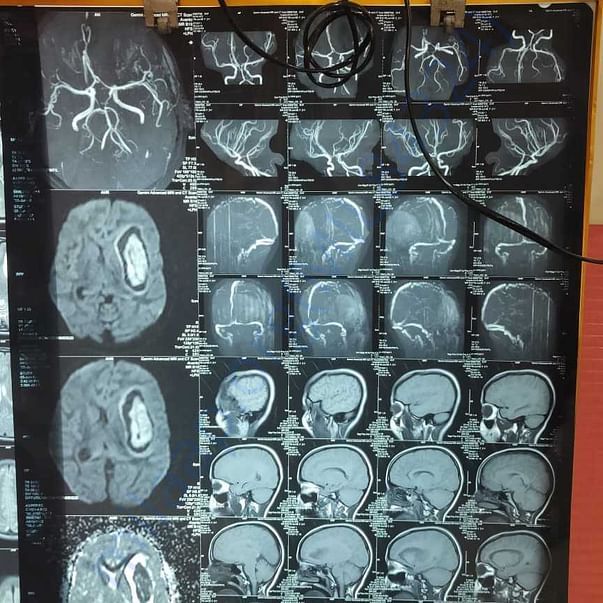 Medical Report