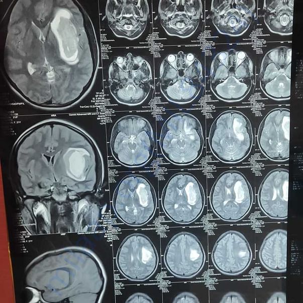 Medical Report