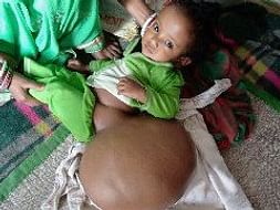 Help Bhavisyawani Fight Tumor