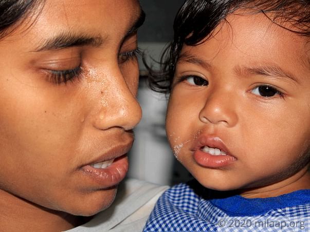 Rishvitha needs your help to undergo her treatment