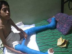 Help Krishna Get Treated for Cerebral Palsy