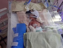 Help Gayathri's on her High risk twin pregnancy with IUGR type 2