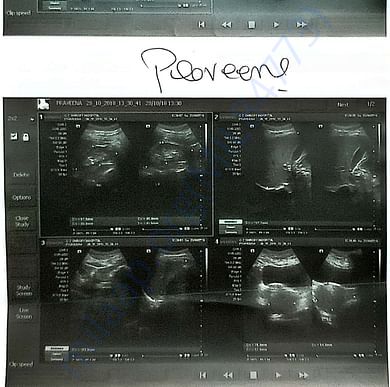 Medical Report
