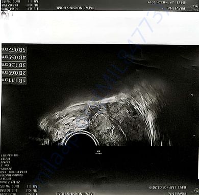 Medical Report