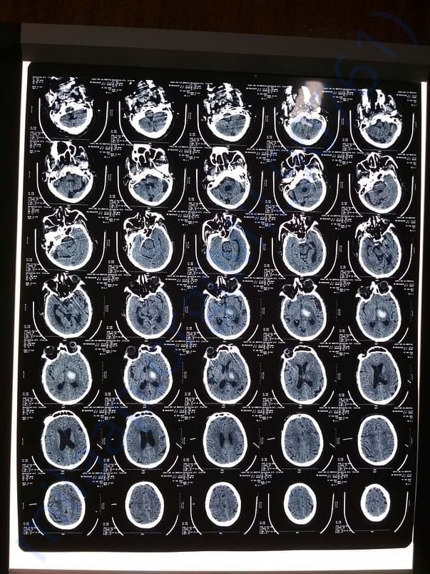 Xray report