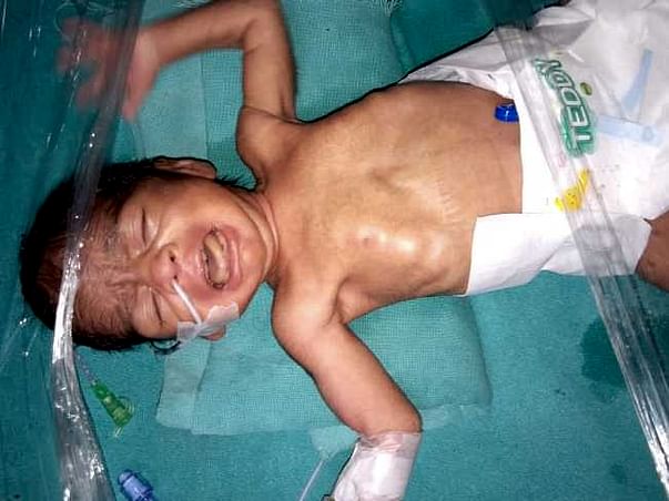 Help premature baby of Kaushal survive NICU journey