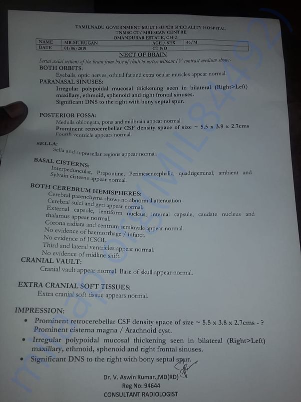 CT scan report