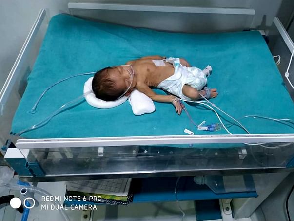 Jyoti's New Born Baby Fights For Each Breath