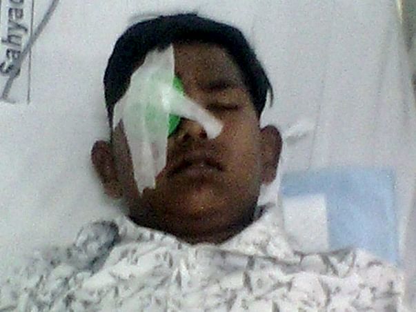 Help Abhay Undergo Removal Of Foreign Object From His Eye's