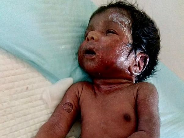 Help Us Save The Little Abandoned Ones