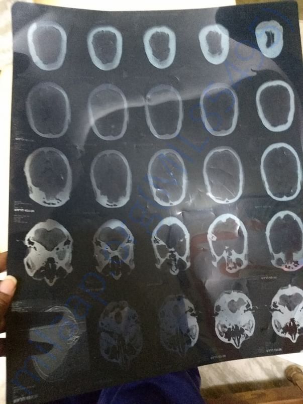 His medical report