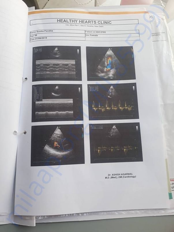 Scan reports