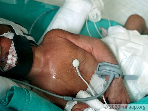Help Mamatha's Premature Baby