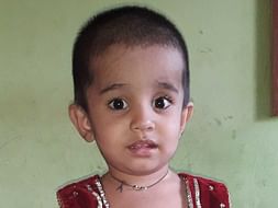 Help little Mishkat Undergo Cochlear Implantation Surgery