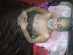 Help my Father fight against cervical Spondylotic Myeloradiculopathy