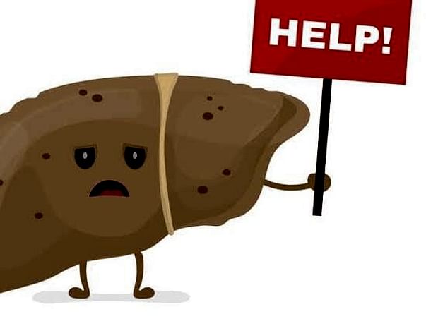 Help Dwimalu Brahma for his liver cancer