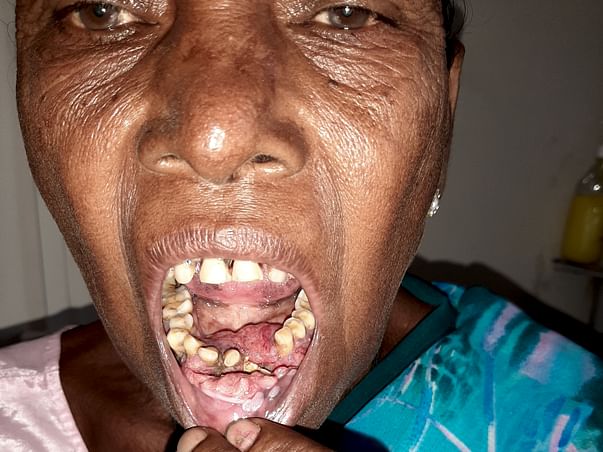 I am helpless, please help me to fight cancer