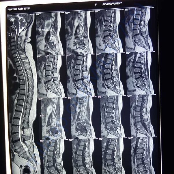 Medical Report