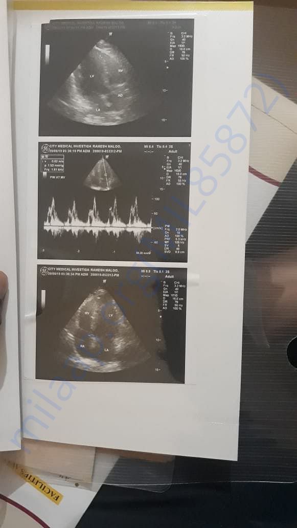 Sonography