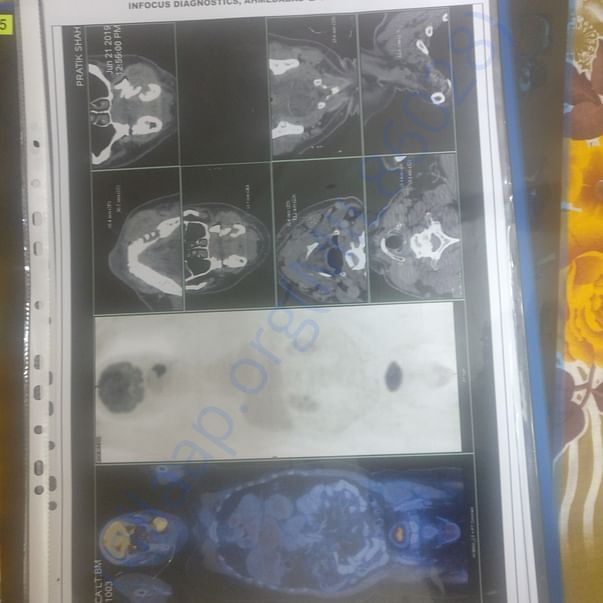 Medical Report