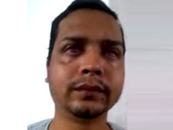 Help Premsingh Undergo An Eye Operation