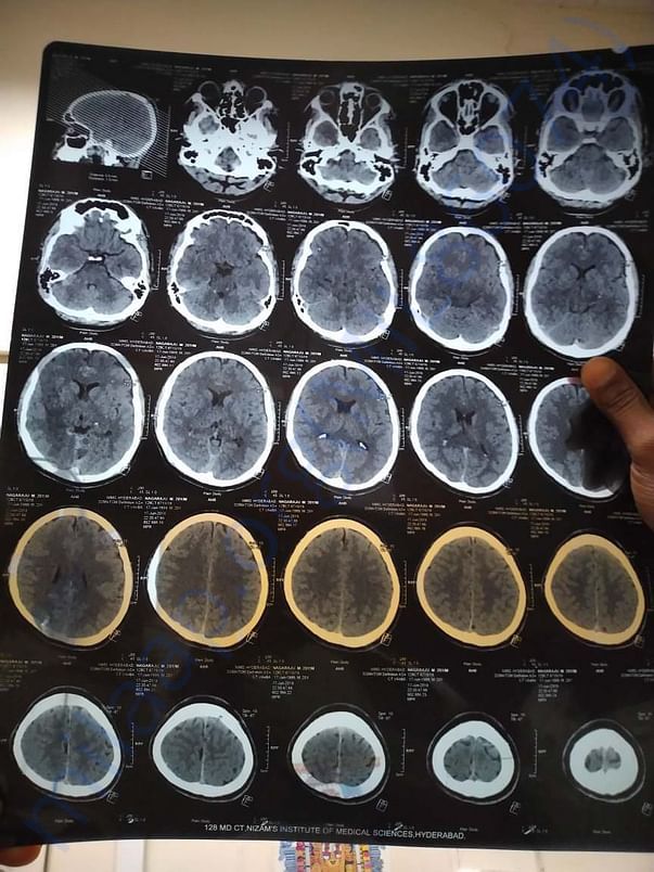 CT scan