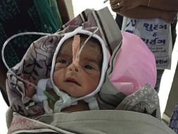 Help Manubhai's Premature To Survive