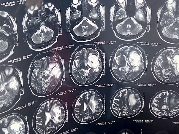 Help for Brain Surgery
