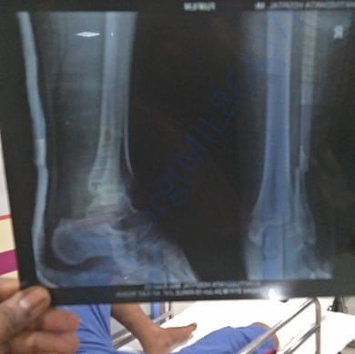 Medical Report