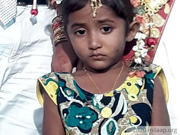 Help Baby Anusha Fight Acute Lymphoblastic Leukemia