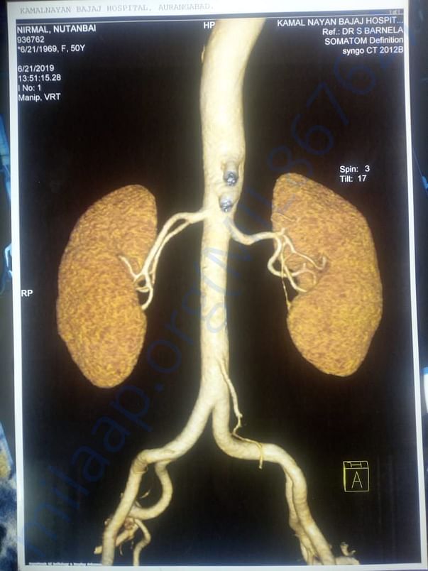 Xray report
